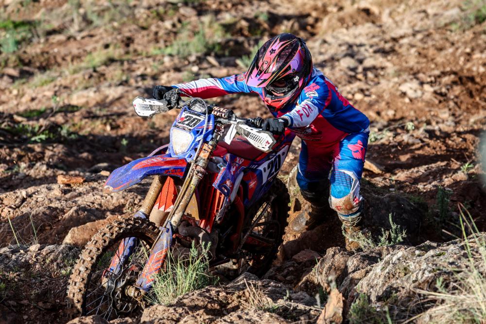 Nil Rojas se operará el lunes de una fractura en la mano derecha.