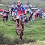 Nil Rojas se operará el lunes de una fractura en la mano derecha.