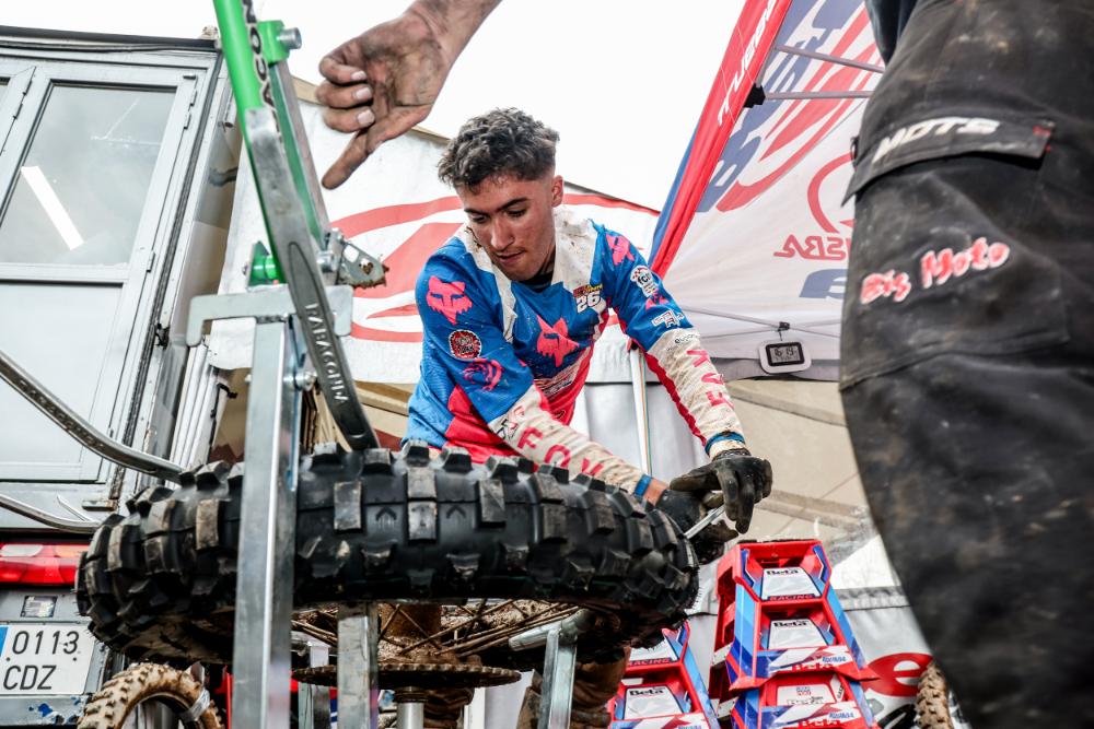 Nil Rojas se operará el lunes de una fractura en la mano derecha.